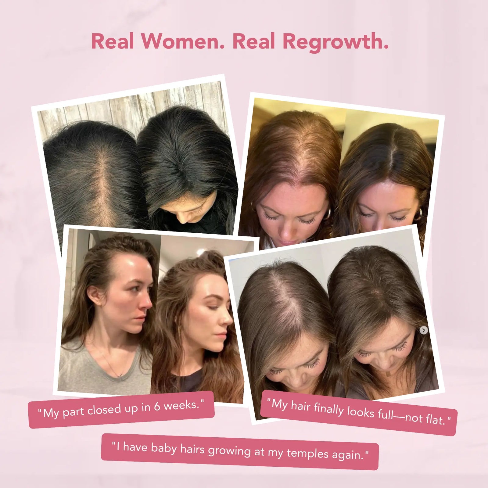 Total Hair Revival System