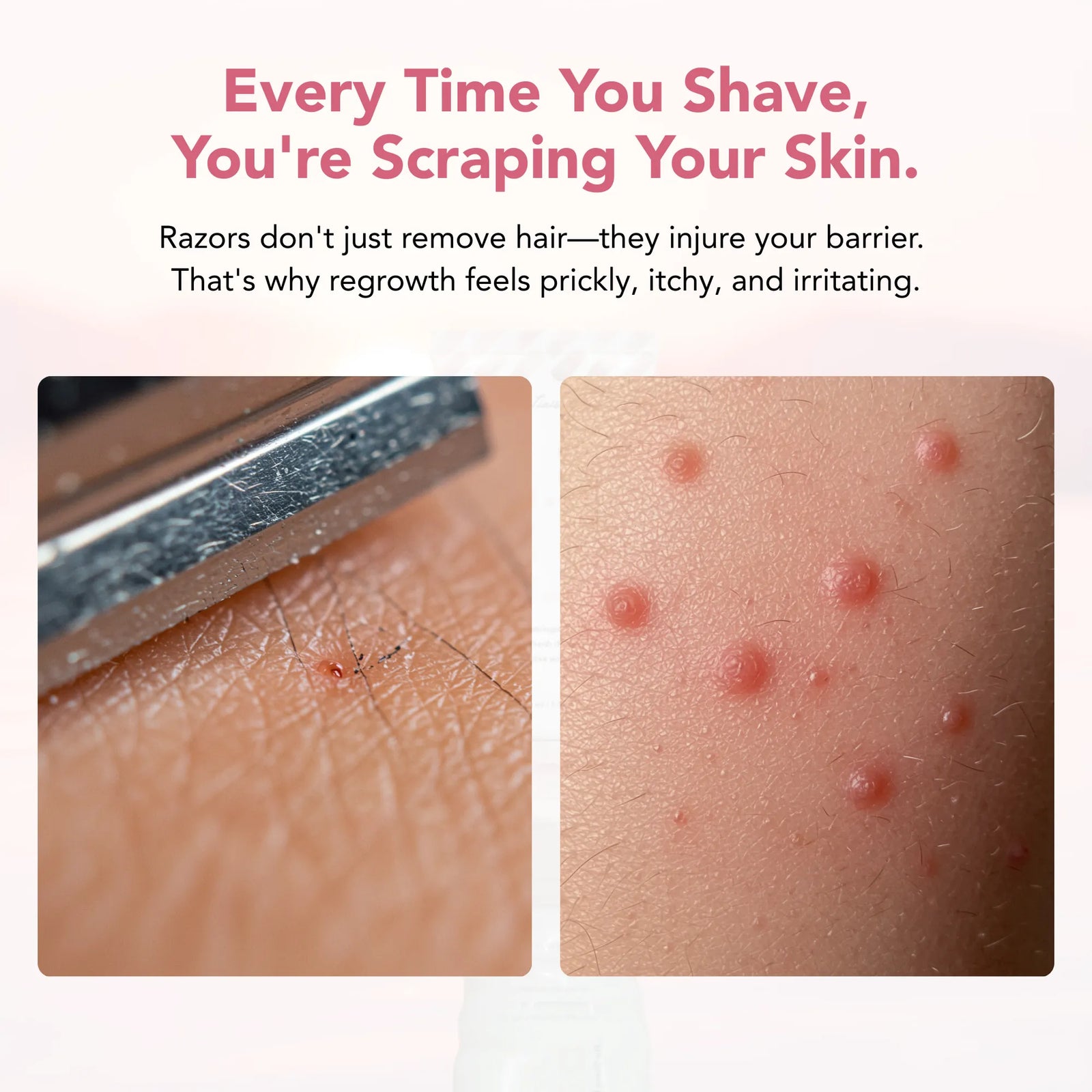 Bare Basics No Shave Hair Removal Cream
