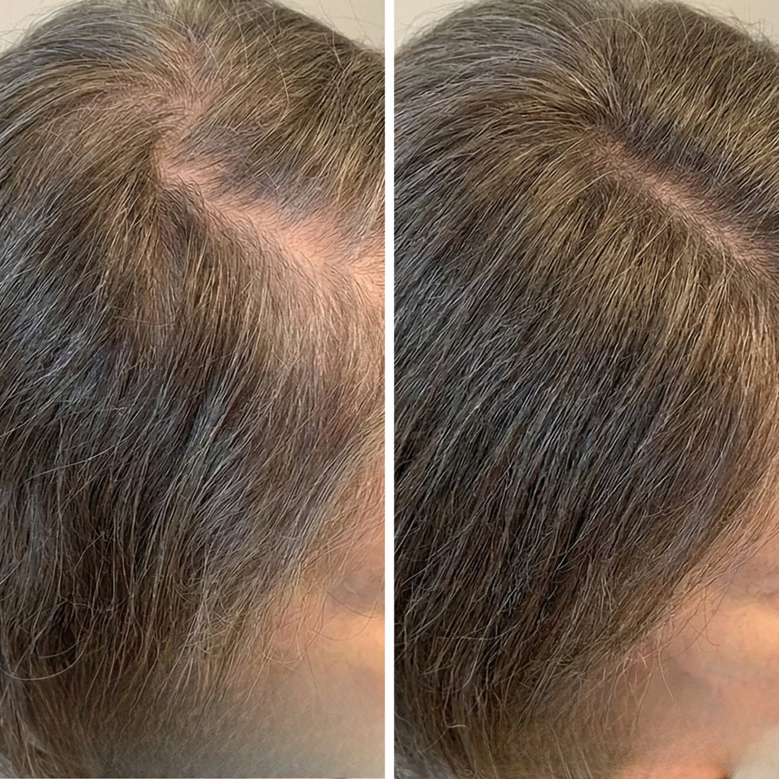 Gray Repair & Protection Duo ($239.96 Value)