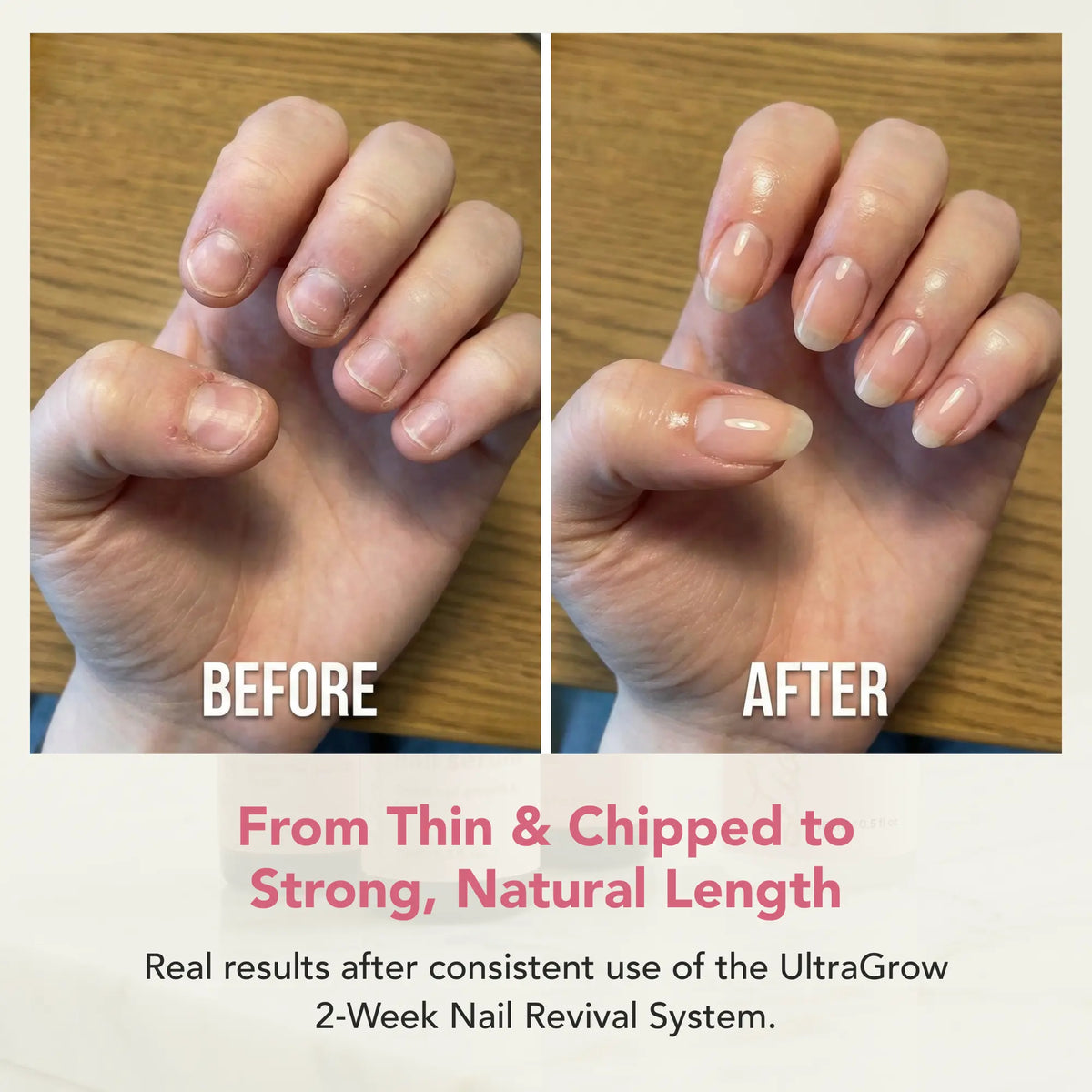 UltraGrow 2-Week Nail Revival System
