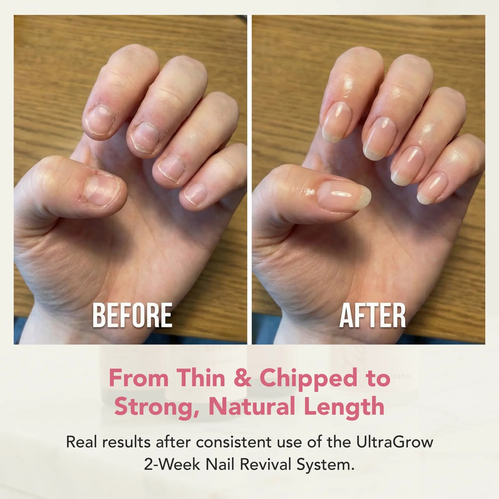 UltraGrow 2-Week Nail Revival System