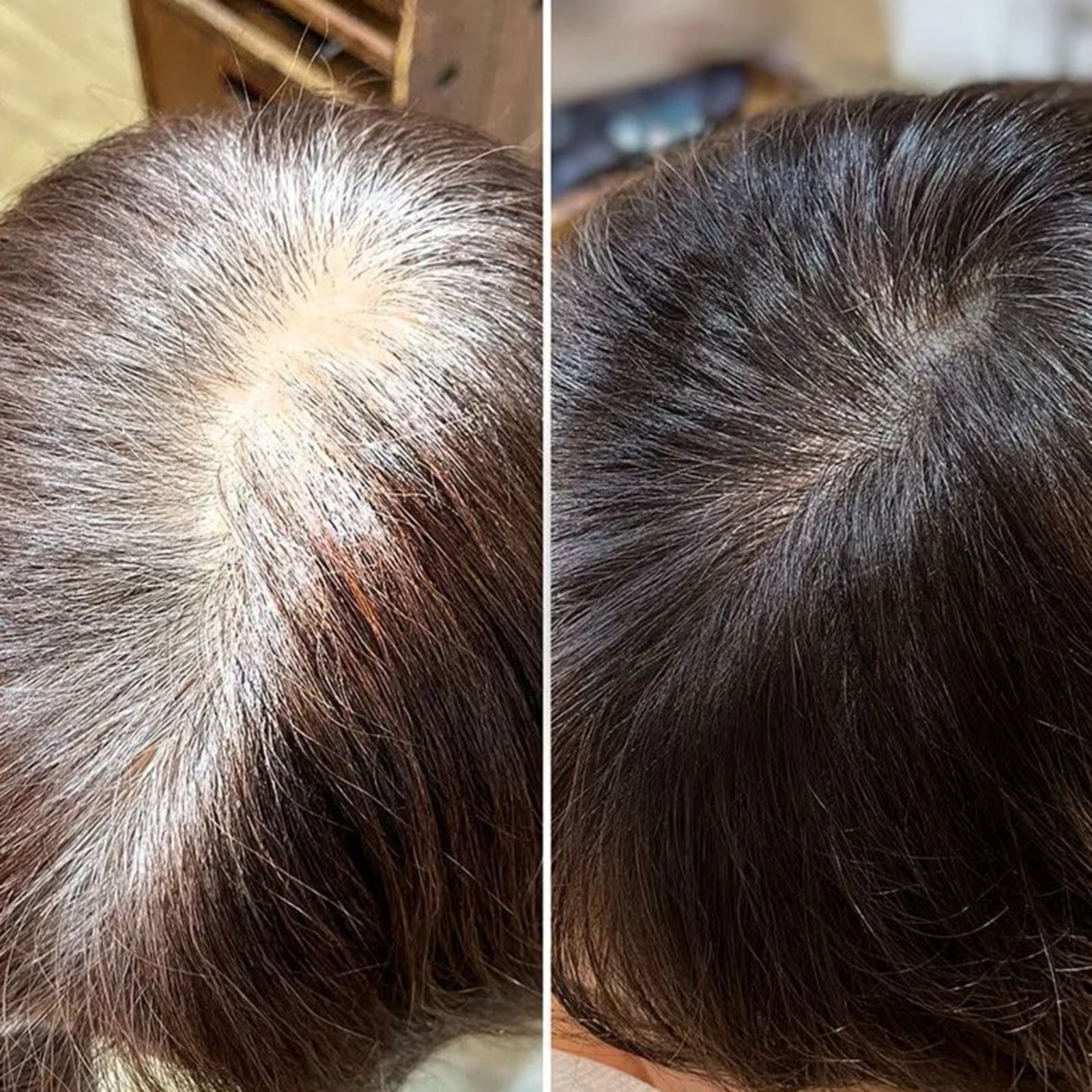 Gray Repair & Protection Duo ($239.96 Value)