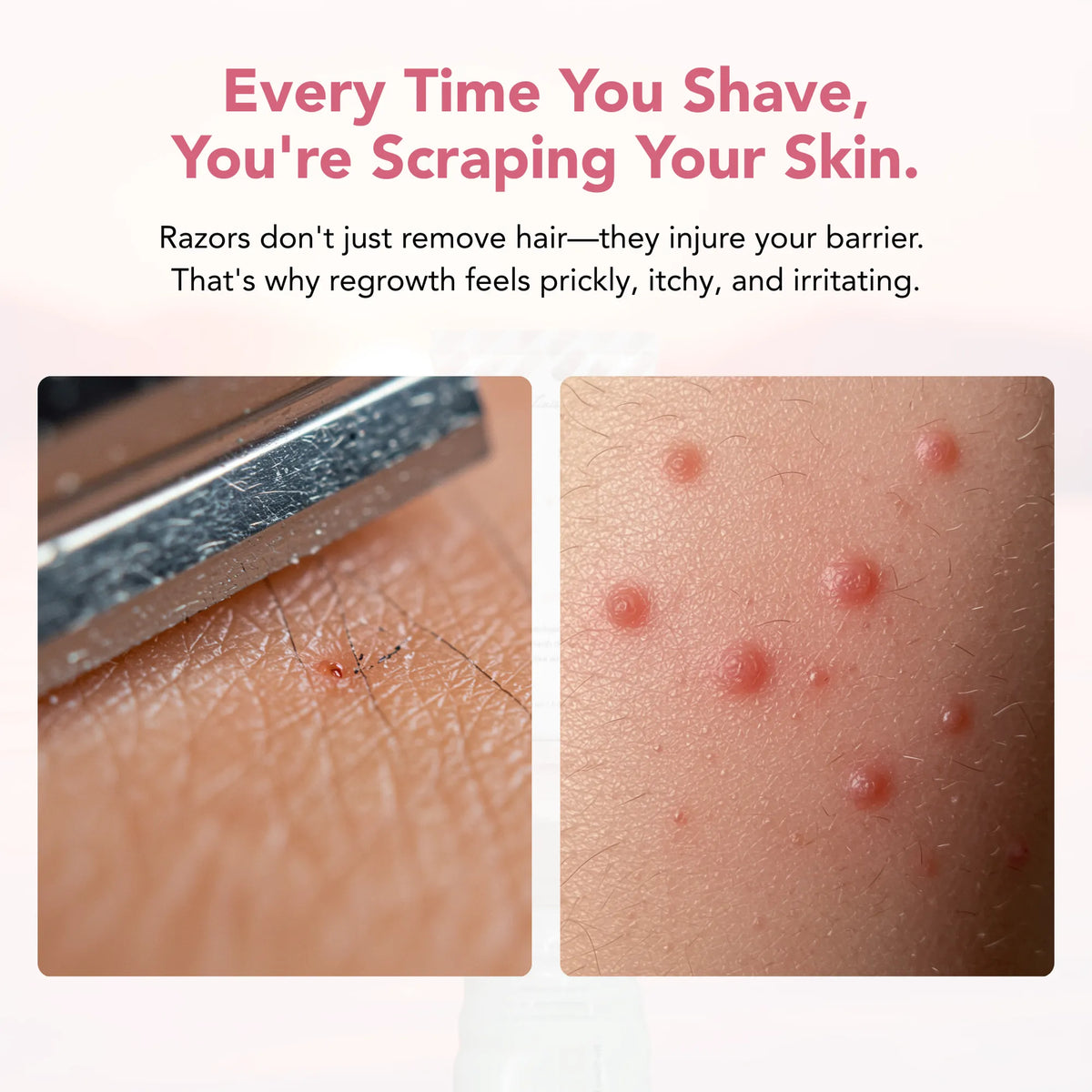 Bare Basics No Shave Hair Removal Cream