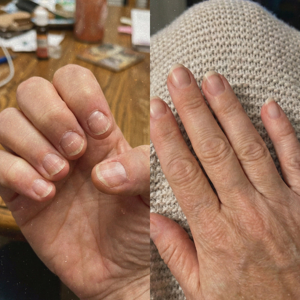 Before and After Results