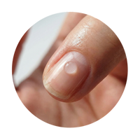 RESTORED FLEXIBILITY