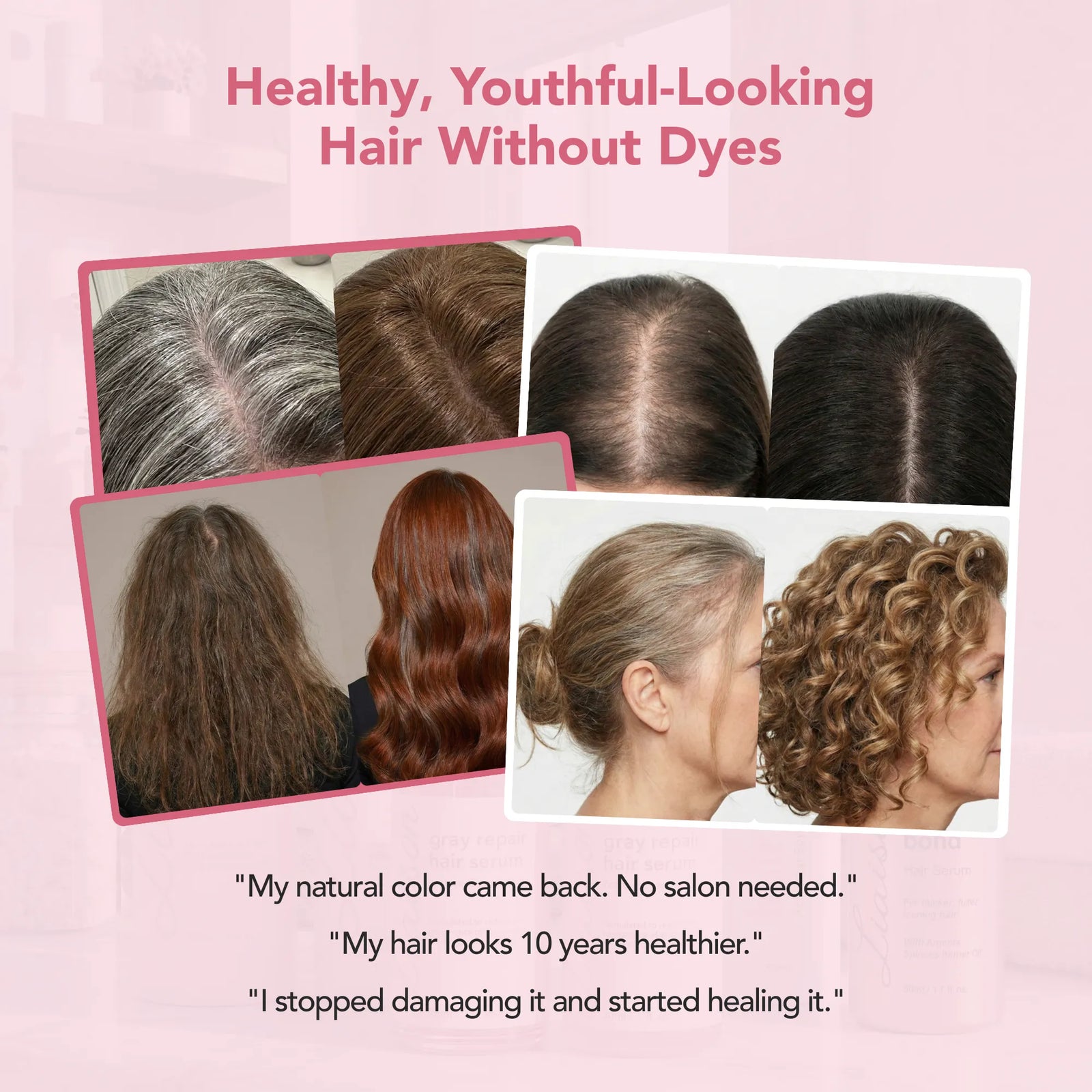 Total Hair Revival System