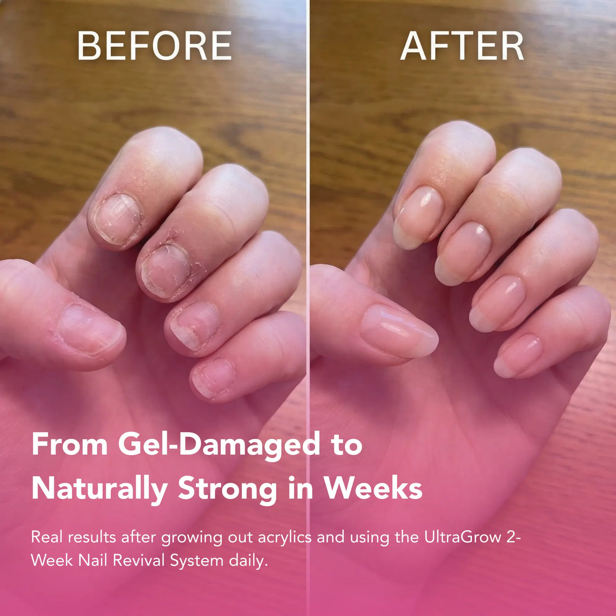 UltraGrow 2-Week Nail Revival System