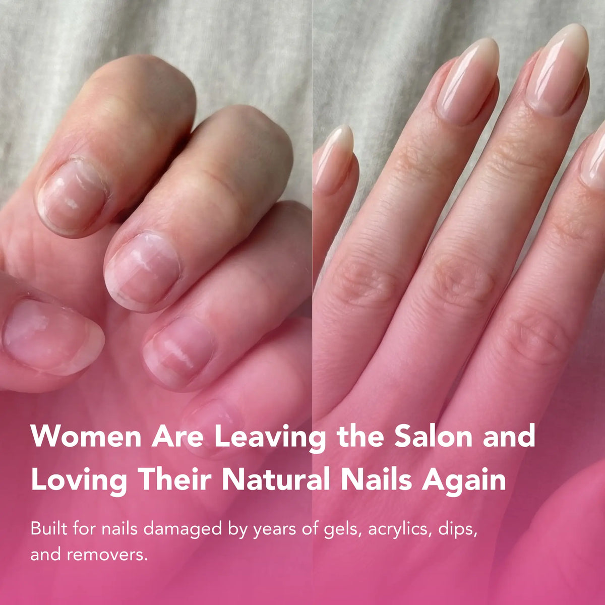 UltraGrow 2-Week Nail Revival System