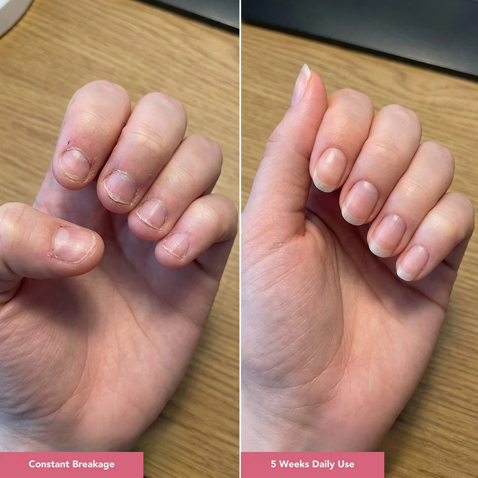 UltraGrow Nail Hydration Restoration System ($169.96 Value)