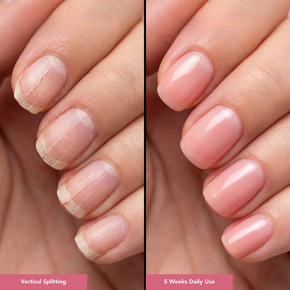 UltraGrow Nail Hydration Restoration System ($169.96 Value)