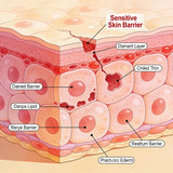 Sensitive Skin