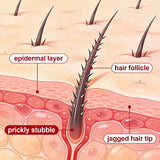 Prickly Regrowth