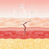 Dry, Reactive Skin