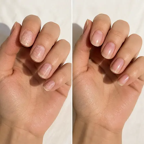 2. Natural nails always feel worse after removing them