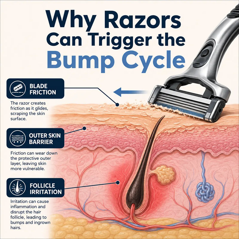 It's Not Your Skin—It's the Razor Itself
