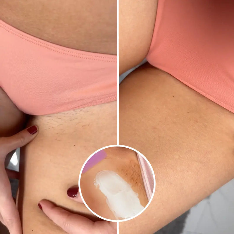 3. It Works on Sensitive Areas Razors Can't Handle