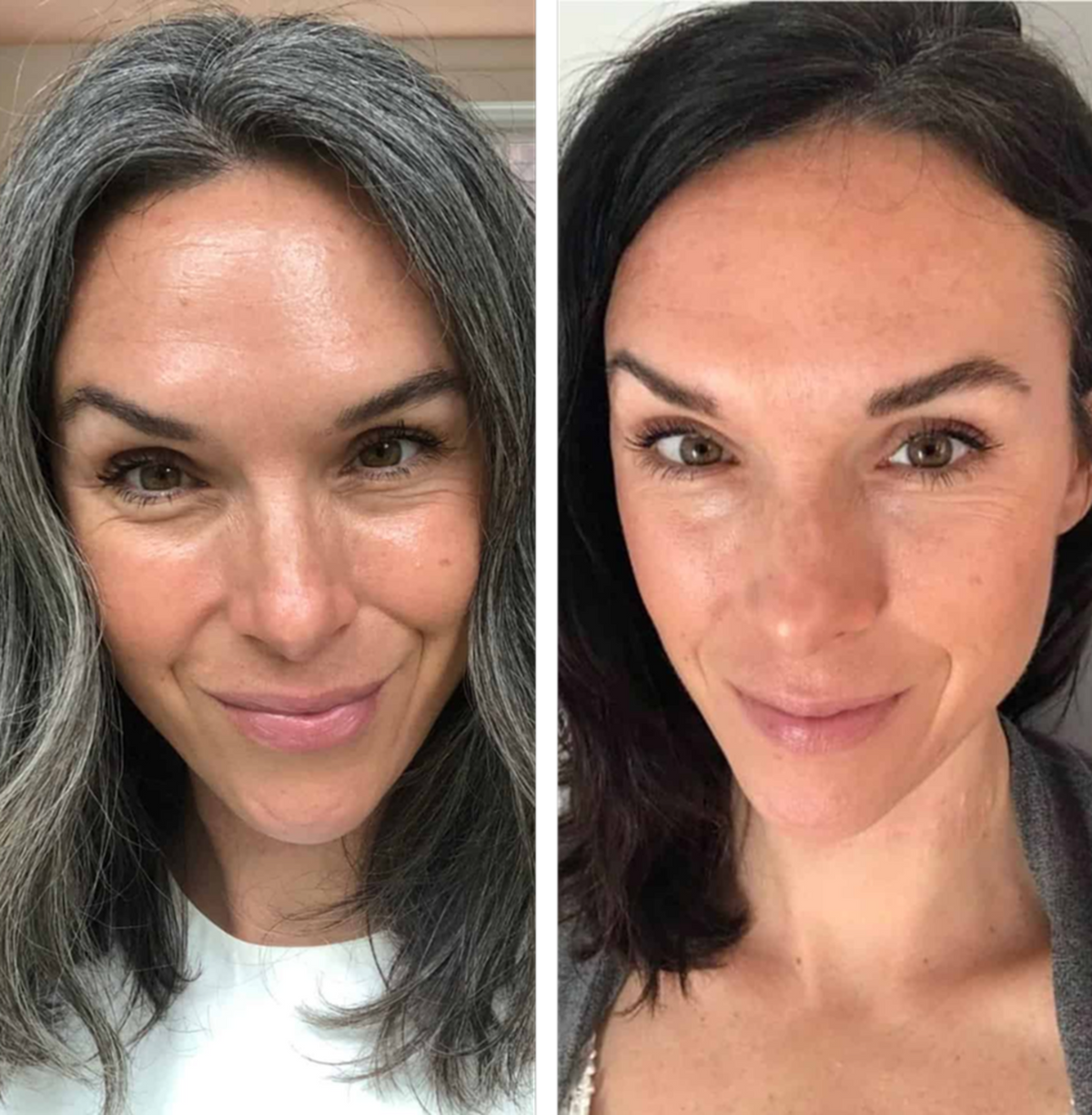 Gray Repair & Protection Duo ($239.96 Value)
