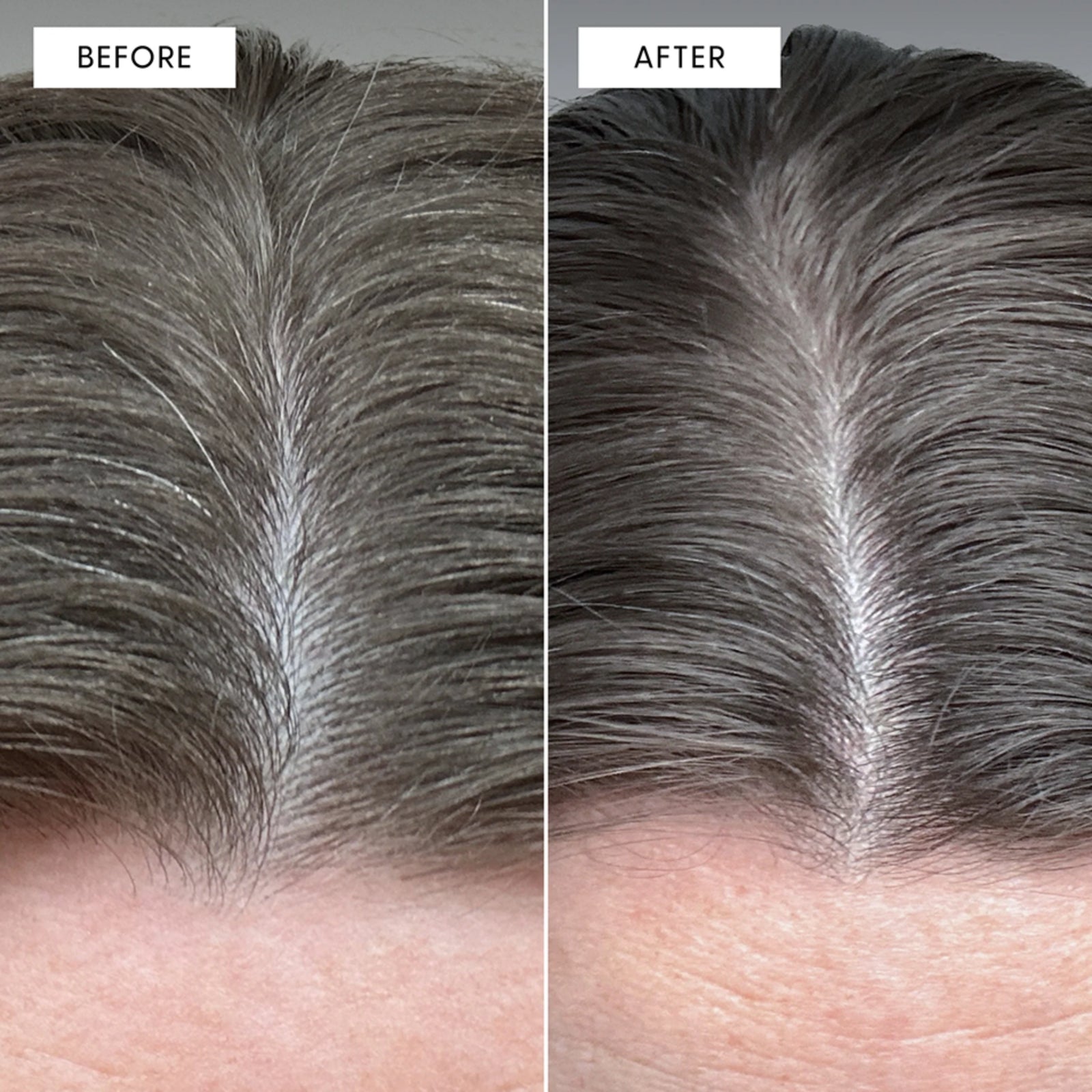 Gray Repair & Protection Duo ($239.96 Value)