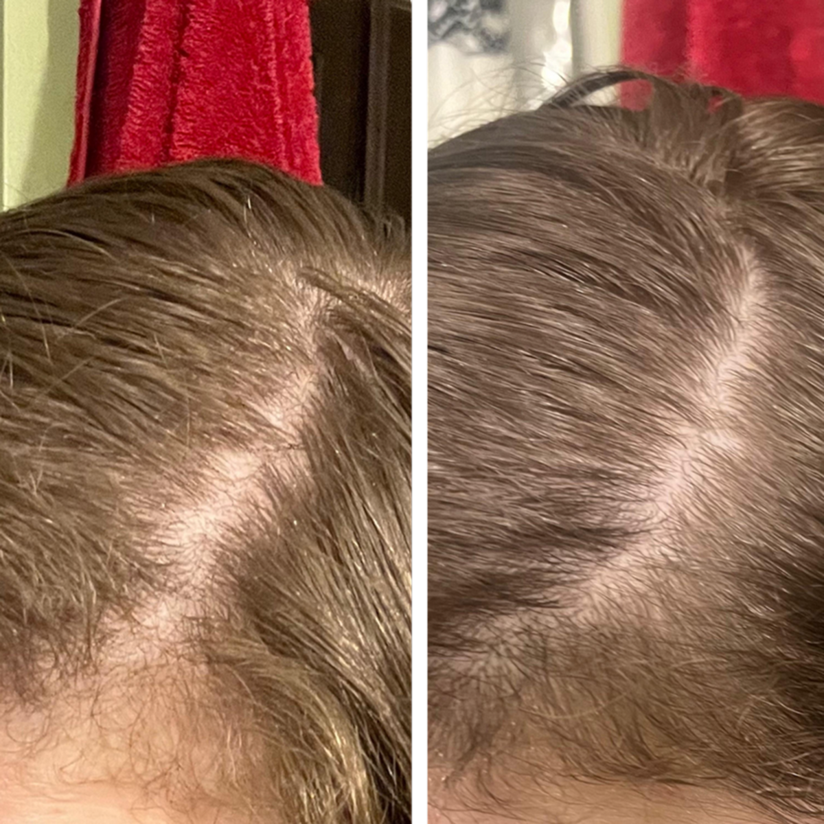 Gray Repair & Protection Duo ($239.96 Value)