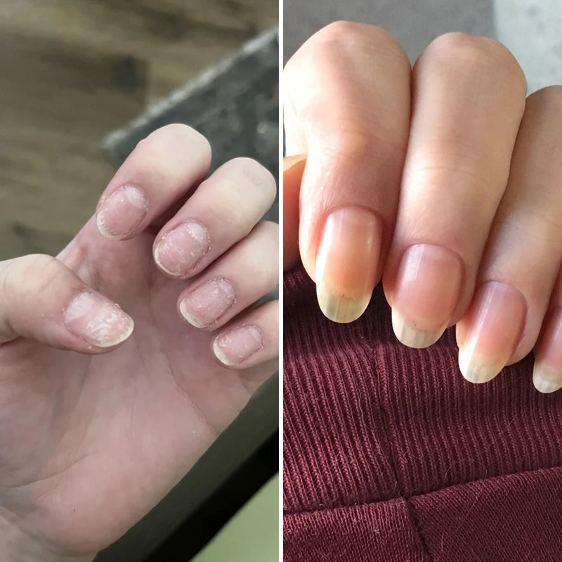 2. It Stops the Peeling Acrylics Cause